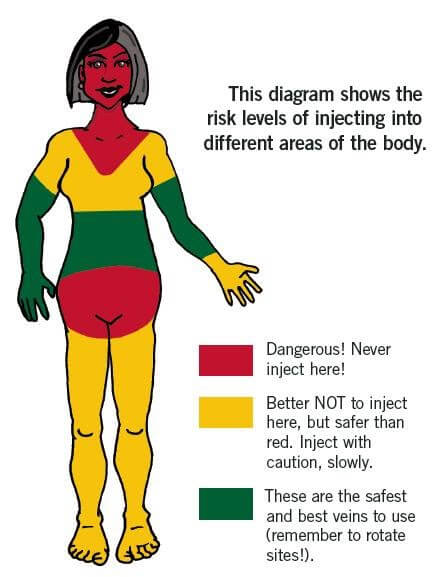 Safe injection Female